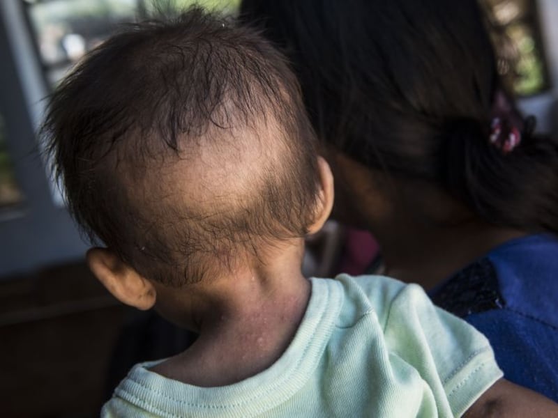 Casi la mitad de la niñez en Guatemala sufre de desnutrición