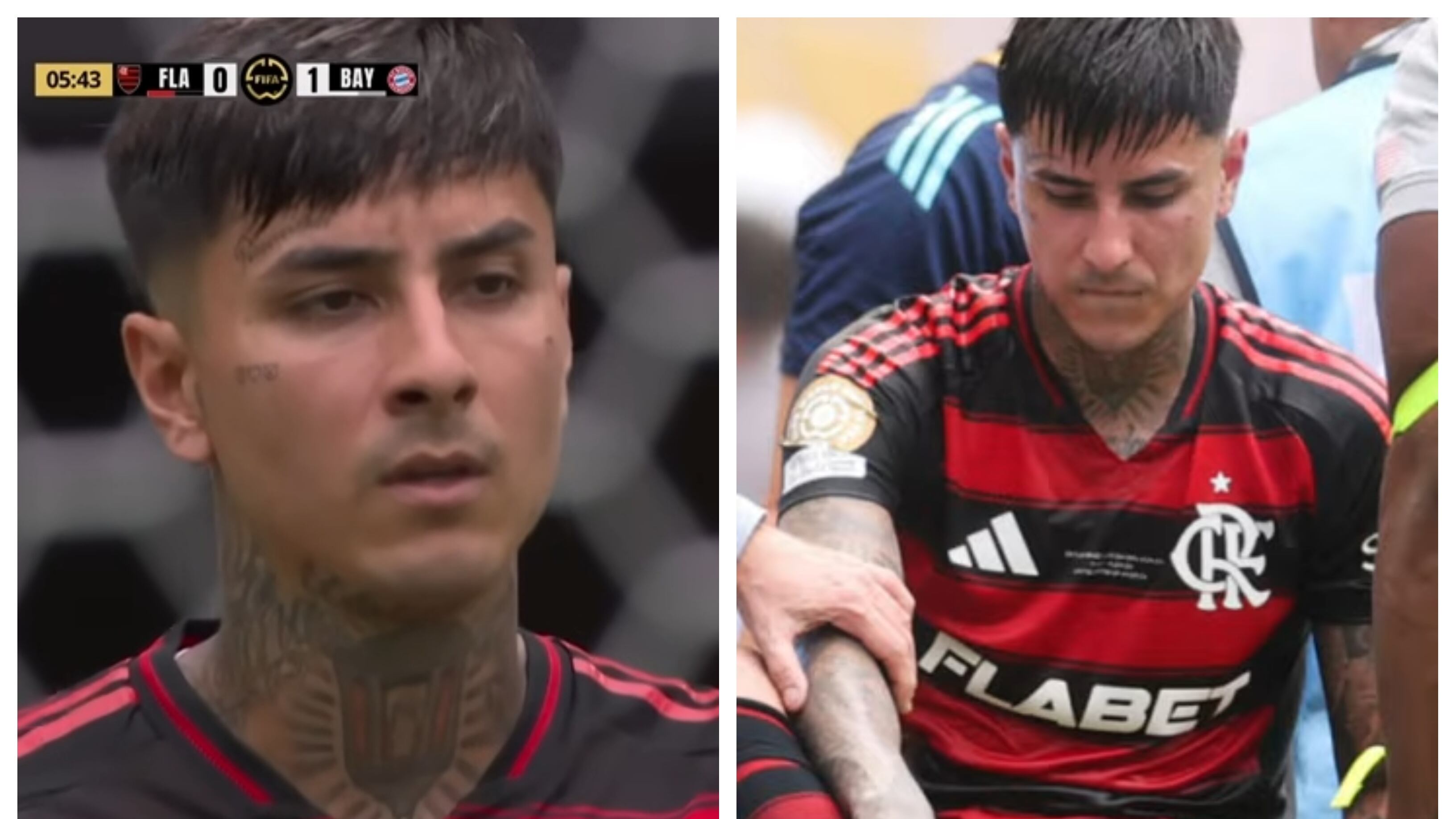 El mediocampista chileno cerró una jornada para el olvido ante Bayern Munich con una severa lesión que lo tendrá al menos dos meses fuera de las canchas.