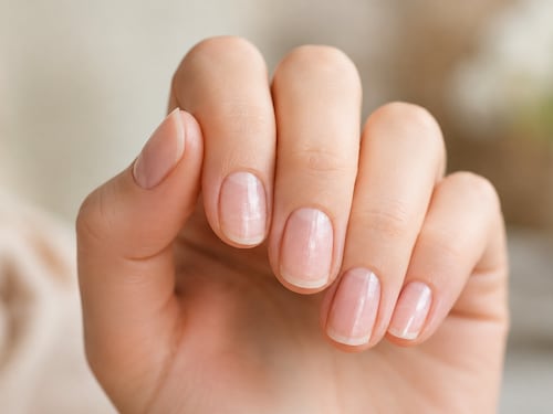 ¿Por qué aparecen líneas o manchas en las uñas? Esto es lo que podría significar, según expertos