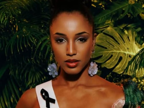 Miss Jamaica reaparece en redes tras grave accidente que la llevó a terapia intensiva