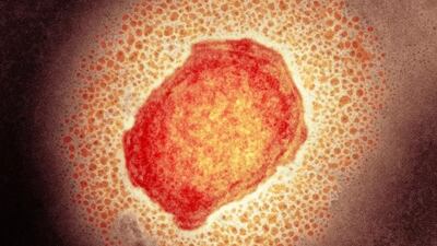 Viruela del mono pasa a llamarse “mpox”, anuncia la OMS